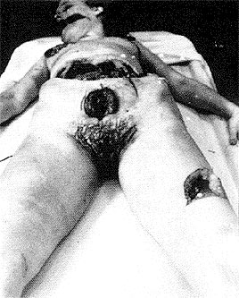 The Black Dahlia -  Elizabeth Short