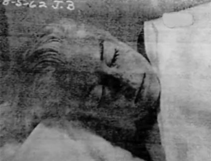 Marilyn Monroe Morgue  Autopsy Photos